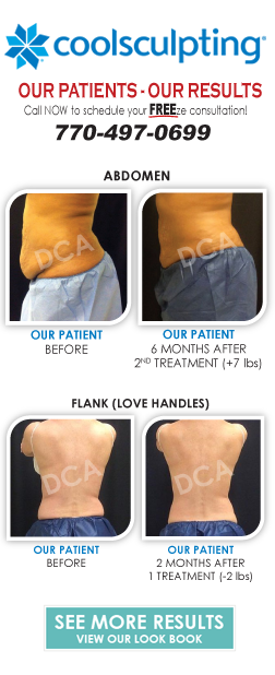 CoolSculpting Before and After Results